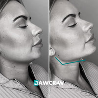 mâchoire carrée femme avant après profil